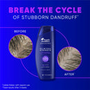 Head & Shoulders Clinical Dandruff Shampoo Twin Pack, Prescription Strength, Oil & Flake Control, Seborrheic Dermatitis Relief, Citrus, 13.5 Fl Oz Each (Set of 2)