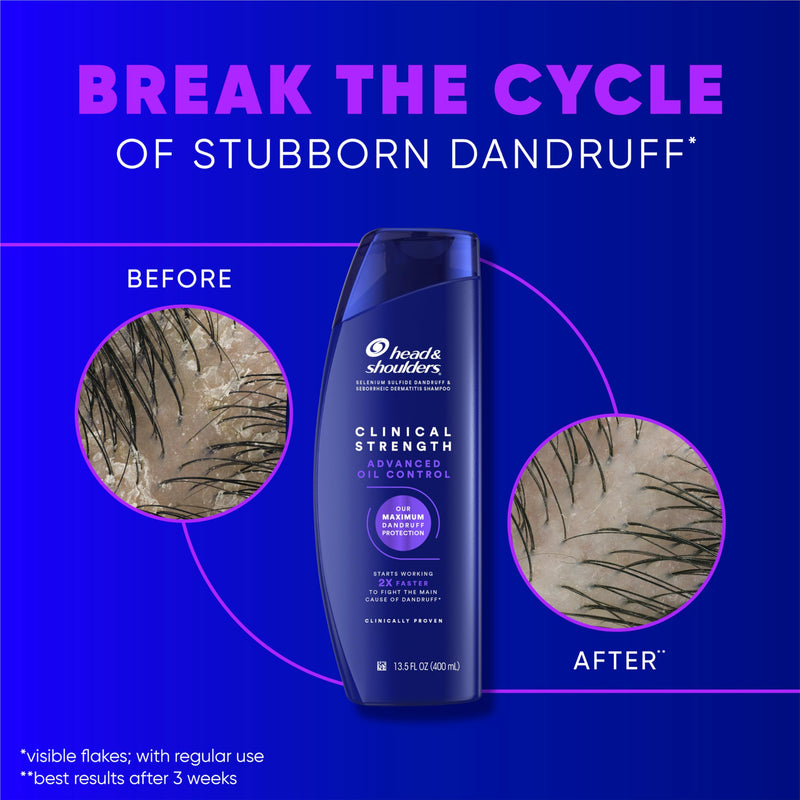 Head & Shoulders Clinical Dandruff Shampoo Twin Pack, Prescription Strength, Oil & Flake Control, Seborrheic Dermatitis Relief, Citrus, 13.5 Fl Oz Each (Set of 2)