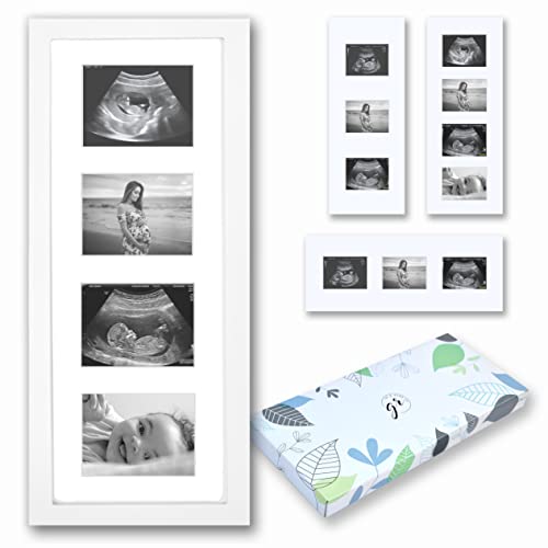 White Wooden Baby Sonogram Picture Frame 3 or 4 Photos | Vertical or Horizontal