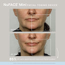 NuFACE Mini Starter Kit – Mini Facial Toning Device with Hydrating Leave-On Gel Primer, 2 Fl Oz