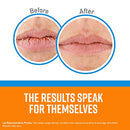 Cooling Relief Lip Repair Lip Balm for Dry, Cracked Lips, Stick, (Pack of 2)