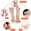 5 Pairs Moisturizing Gel Heel Socks Open Toe Socks