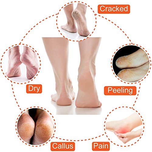 5 Pairs Moisturizing Gel Heel Socks Open Toe Socks