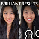 GLO Brilliant Personal Teeth Whitening Device