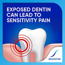 Extra Whitening Sensitive Teeth Whitening Toothpaste - 4 Ounces (Pack of 3)