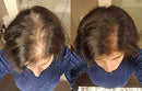 Thickening Hair Loss Treatment for Women