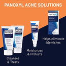 Acne Foaming Wash Benzoyl Peroxide 10% Maximum Strength Antimicrobial