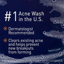 Acne Foaming Wash Benzoyl Peroxide 10% Maximum Strength Antimicrobial