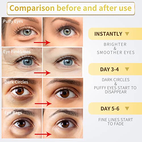 Under Eye Patches - 30 Pairs - 24K Gold Eye Mask- Puffy Eyes & Dark Circles Treatments